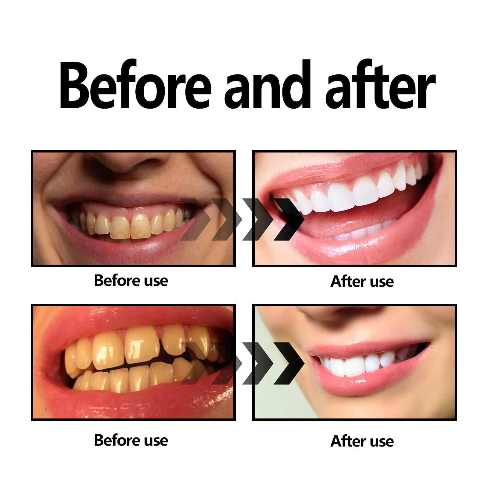 Activated Coconut Charcoal Too - Teeth Whitening Charcoal Powder avaliação e preço