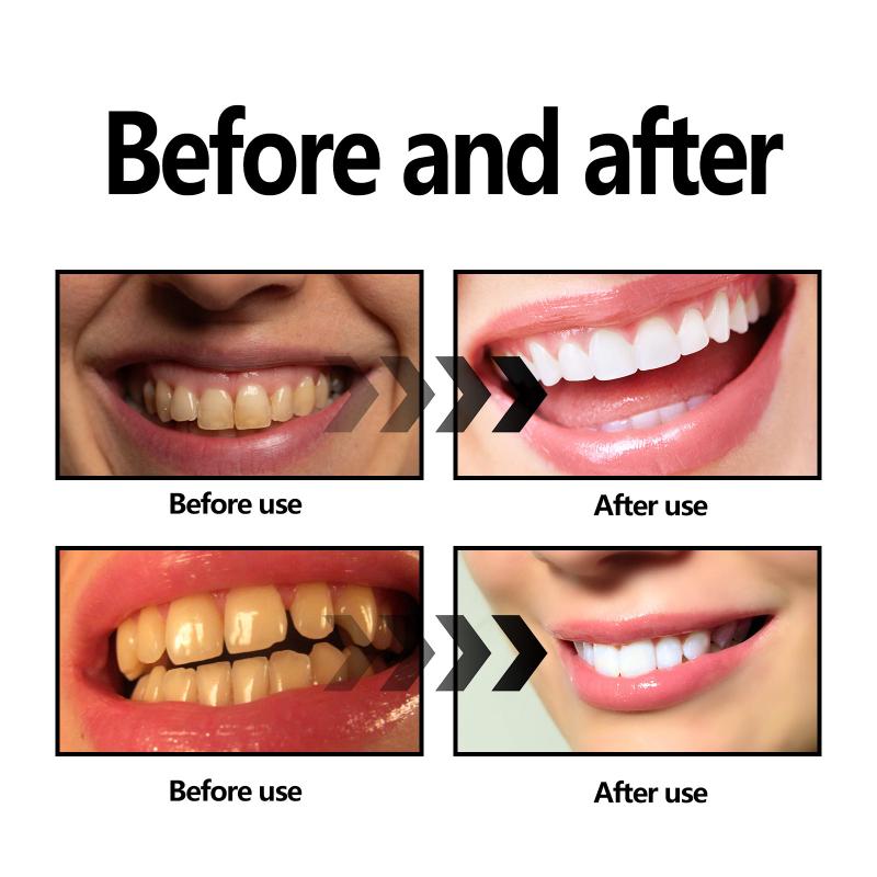 Teeth Whitening Powder Charcoa - Teeth Whitening Charcoal Powder avaliação e preço