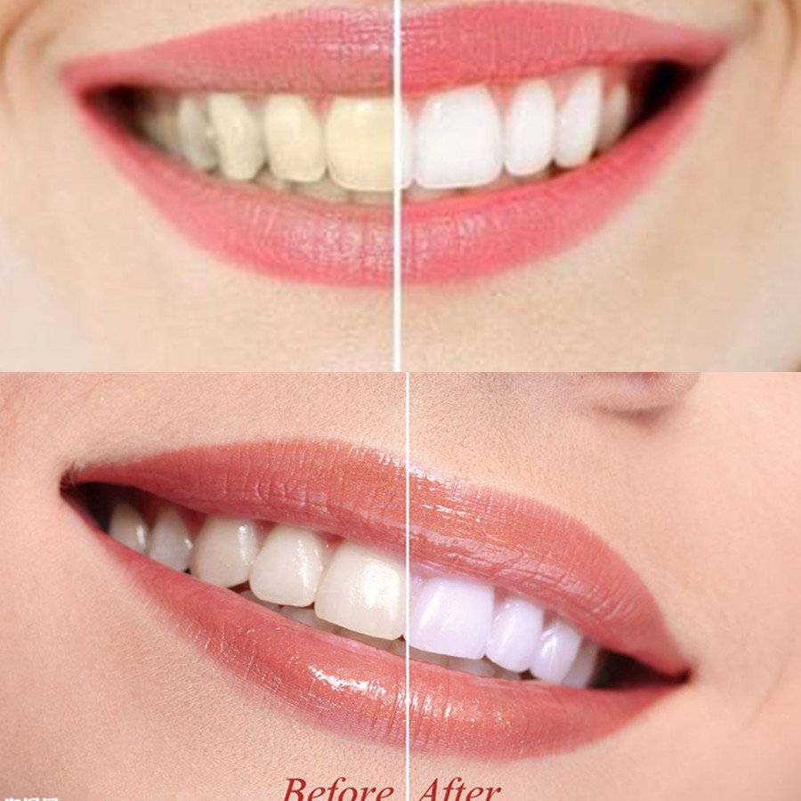 Bamboo Charcoal Teeth Tooth De - Teeth Whitening Charcoal Powder avaliação e preço