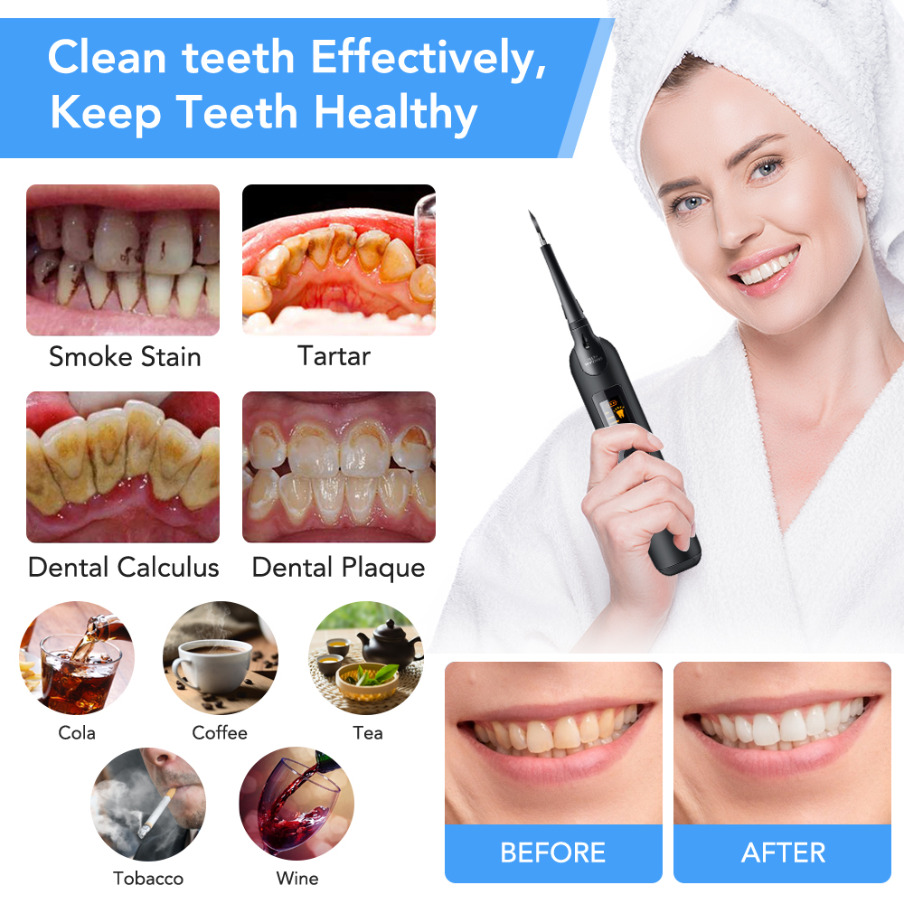 Teeth Tartar Remover Electric  - Teeth Whitening Led Kit avaliação e preço