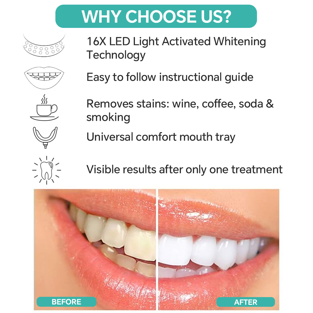 Teeth Whitening Accelerator Li - Teeth Whitening With Blue Light avaliação e preço