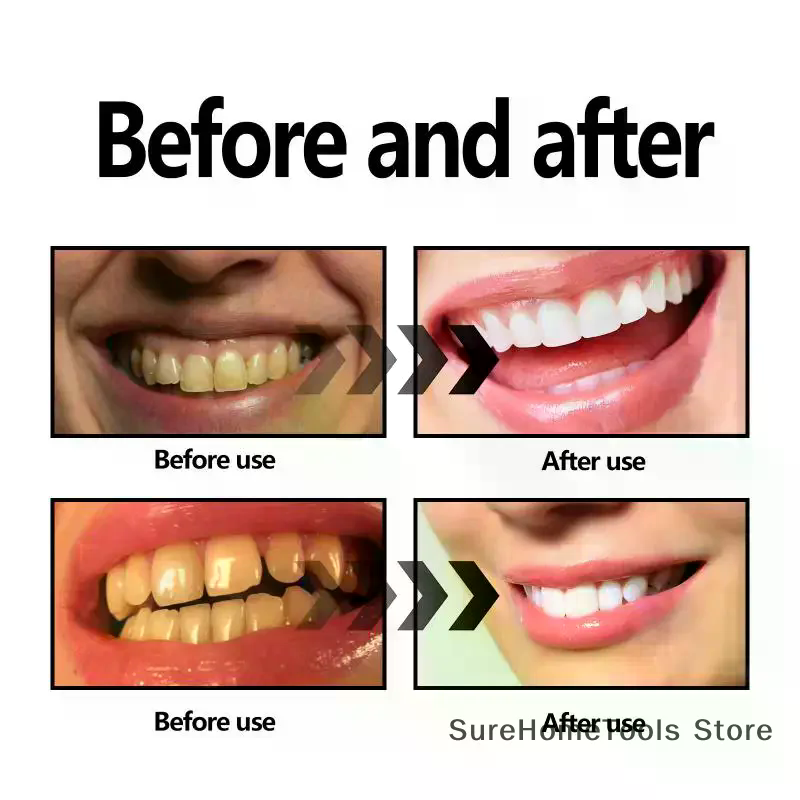 Bamboo Charcoal Powder For Tee - Teeth Whitening Charcoal Powder avaliação e preço