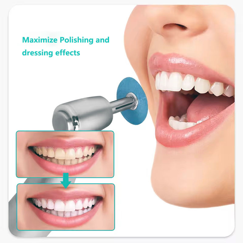 40pcs Dental Polishing Discs H - Teeth Whitening Express avaliação e preço