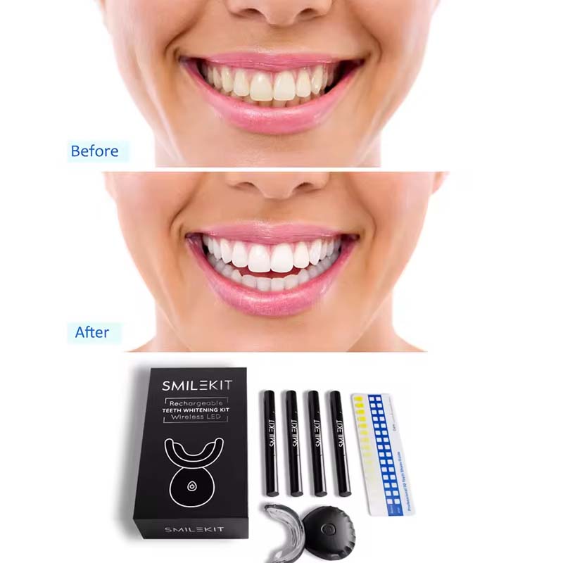 Wholesale Approved Private log - Teeth Whitening Led Kit avaliação e preço