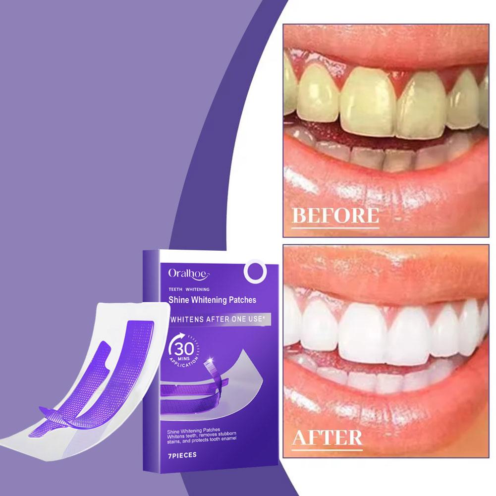 Purple Teeth Whitening Strips  - Teeth Whitening/Bleaching avaliação e preço